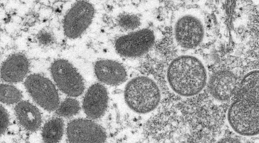 OMS confirma 132 casos de varíola dos macacos, e diz que surto “pode ser contido”