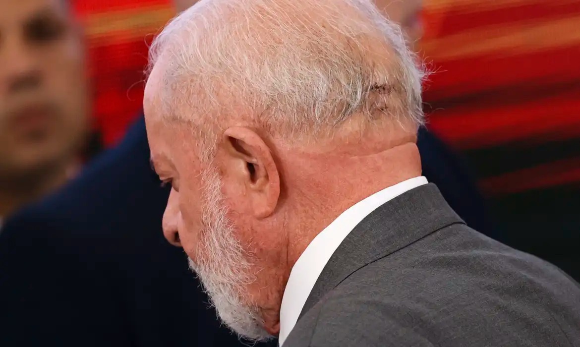 Lula é proibido de atividades físicas e vasodilatadores após hemorragia cerebral