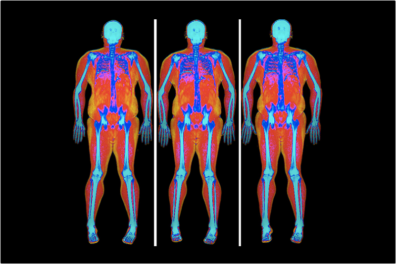 BodyScan flagra drogas em visitantes e impede entrada de entorpecentes em presídio de Salvador