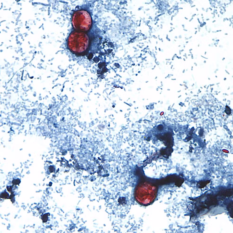 Parasita intestinal causa surto de diarreia grave nos EUA